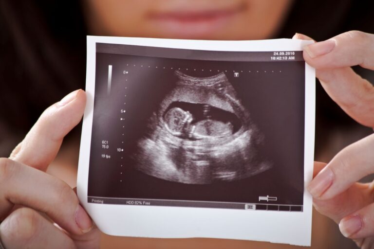 Woman holding sonogram image