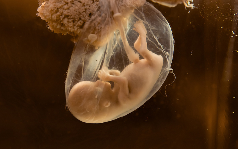 photograph of human embryo development in the womb.