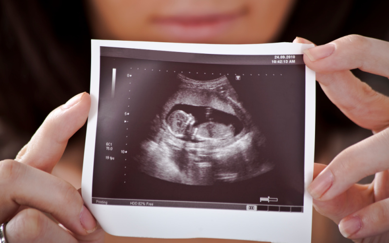 woman holding sonogram picture