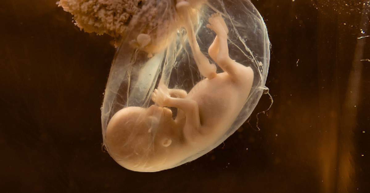 Conception, implantation or birth? When does life begin?