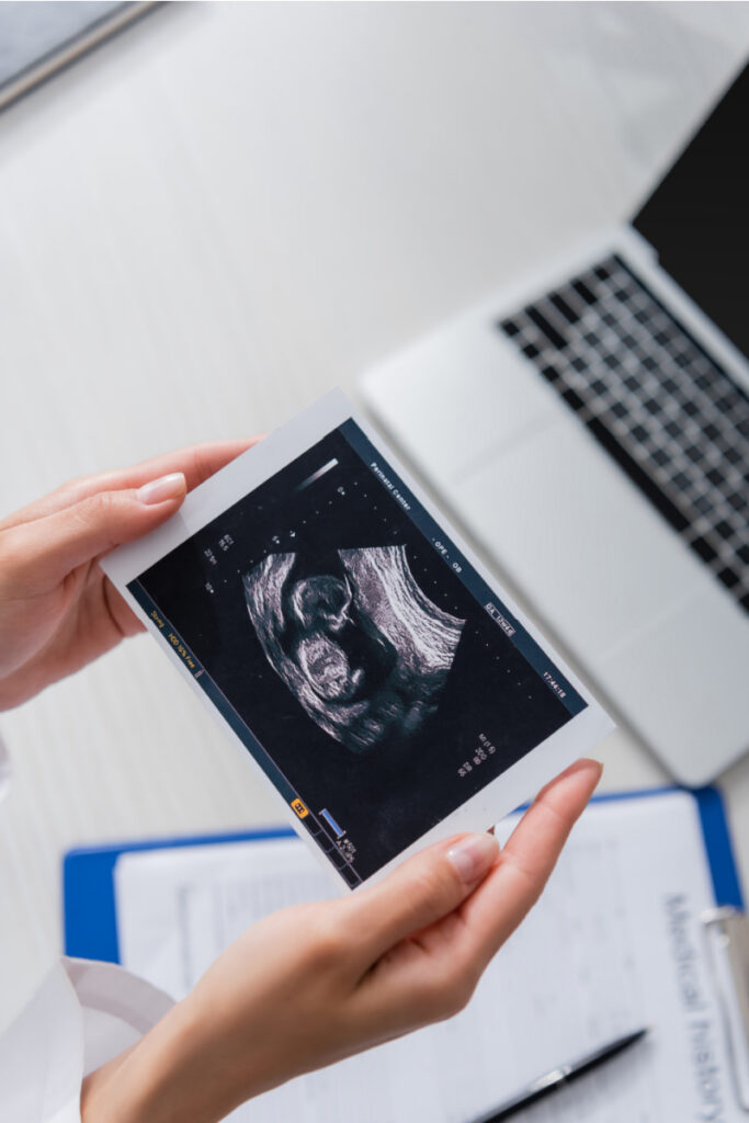 Doctor holding an ultrasound image with laptop and medical chart in background.