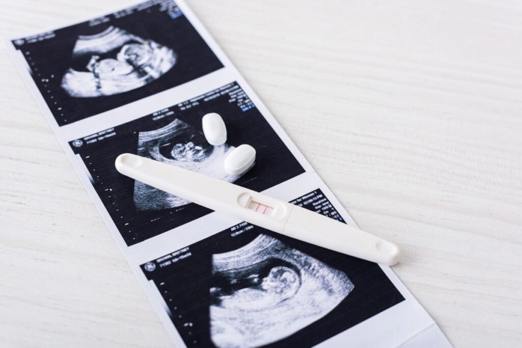 Strip of sonogram photos with pregnancy test and pills on top.