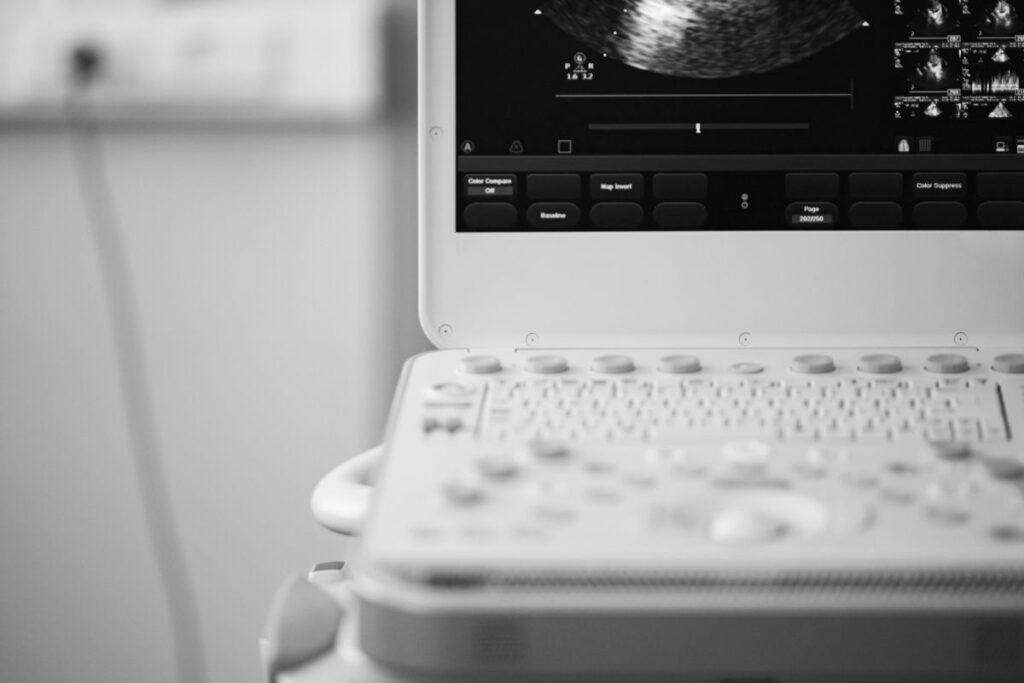 Image of sonogram machine